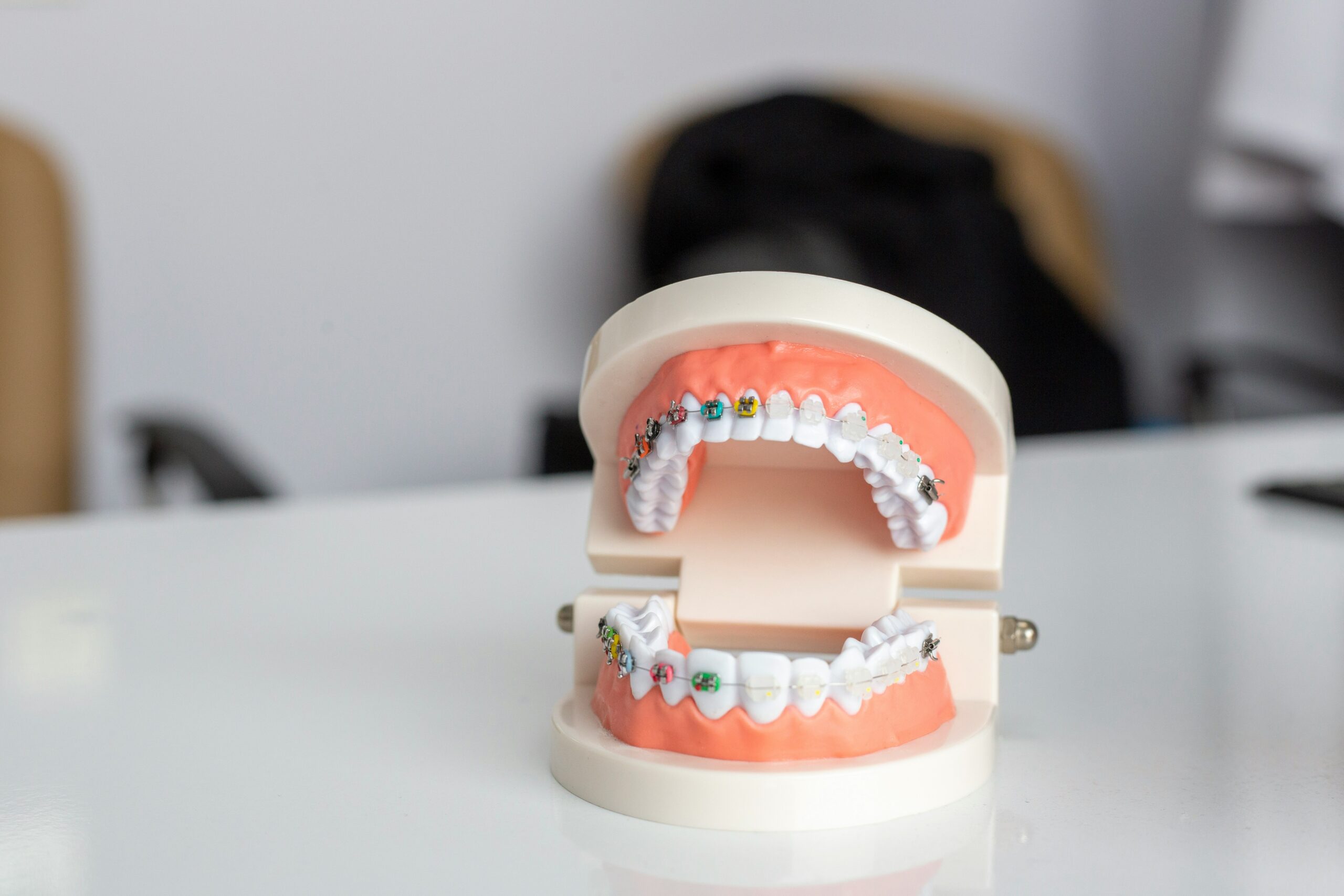 Common orthodontic issues